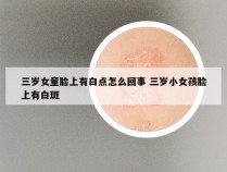 三岁女童脸上有白点怎么回事 三岁小女孩脸上有白斑