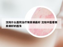 沈阳什么医院治疗银屑病最好 沈阳中医看银屑病好的医生