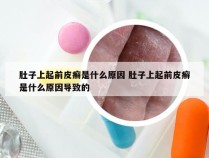 肚子上起前皮癣是什么原因 肚子上起前皮癣是什么原因导致的