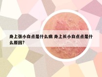 身上张小白点是什么病 身上长小白点点是什么原因?