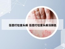 伍德灯检查头癣 伍德灯检查头癣没颜色