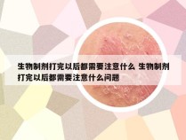 生物制剂打完以后都需要注意什么 生物制剂打完以后都需要注意什么问题