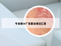 牛皮癣小广告整治情况汇报