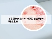 寻常型银屑病pasi 寻常型银屑病pasi评分量表