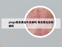 yingx银杏果治牛皮癣吗 银杏果治皮肤病吗