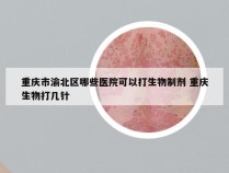 重庆市渝北区哪些医院可以打生物制剂 重庆生物打几针