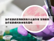 治疗皮肤的生物制剂有什么副作用 生物制剂治疗皮肤病对身体有伤害吗