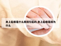 身上起癣是什么原因引起的 身上起癣是因为什么