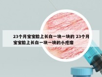 23个月宝宝脸上长白一块一块的 23个月宝宝脸上长白一块一块的小疙瘩