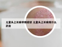 儿童头上长癣早期症状 儿童头上长癣用什么药膏