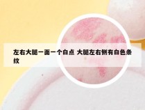 左右大腿一面一个白点 大腿左右侧有白色条纹