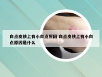 白点皮肤上有小白点原因 白点皮肤上有小白点原因是什么