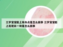 三岁宝宝脸上有白点是怎么回事 三岁宝宝脸上出现白一块是怎么回事