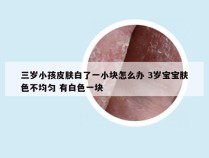 三岁小孩皮肤白了一小块怎么办 3岁宝宝肤色不均匀 有白色一块