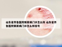 山东省齐鲁医院银屑病门诊怎么样 山东省齐鲁医院银屑病门诊怎么样挂号