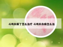 斗鸡长癣了怎么治疗 斗鸡长白癣怎么治