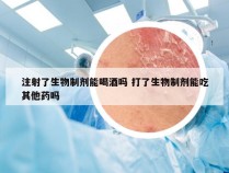 注射了生物制剂能喝酒吗 打了生物制剂能吃其他药吗