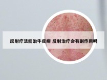 反射疗法能治牛皮癣 反射治疗会有副作用吗