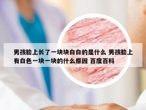 男孩脸上长了一块块白白的是什么 男孩脸上有白色一块一块的什么原因 百度百科