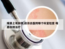 嘴唇上有白斑,应该去医院哪个科室检查 嘴唇白斑治疗