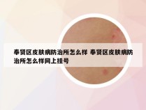 奉贤区皮肤病防治所怎么样 奉贤区皮肤病防治所怎么样网上挂号