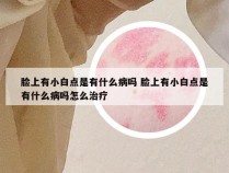 脸上有小白点是有什么病吗 脸上有小白点是有什么病吗怎么治疗