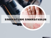 生物制剂治疗过敏吗 生物制剂治疗皮肤过敏