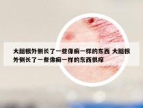 大腿根外侧长了一些像癣一样的东西 大腿根外侧长了一些像癣一样的东西很痒