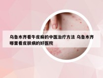 乌鲁木齐看牛皮癣的中医治疗方法 乌鲁木齐哪里看皮肤病的好医院