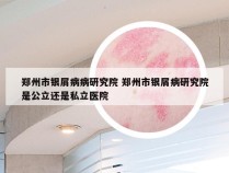 郑州市银屑病病研究院 郑州市银屑病研究院是公立还是私立医院