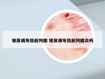 银屑病导致前列腺 银屑病导致前列腺炎吗