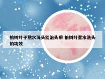 柏树叶子熬水洗头能治头癣 柏树叶煮水洗头的功效