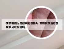 生物制剂治皮肤病能报销吗 生物制剂治疗皮肤病可以报销吗