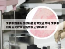 生物制剂用后皮肤颜色能恢复正常吗 生物制剂用后皮肤颜色能恢复正常吗知乎