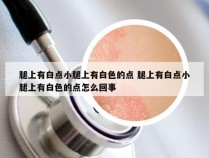 腿上有白点小腿上有白色的点 腿上有白点小腿上有白色的点怎么回事