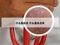 什么是白点 什么是白点风