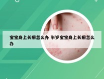 宝宝身上长癣怎么办 半岁宝宝身上长癣怎么办