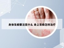 身体生癣要注意什么 身上生癣怎样治疗