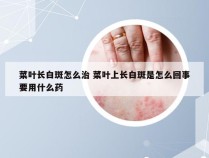 菜叶长白斑怎么治 菜叶上长白斑是怎么回事要用什么药