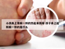 小孩身上像癣一样的热起来很痒 孩子身上起和癣一样的是什么