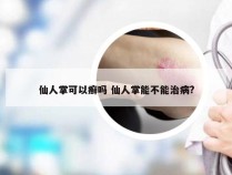 仙人掌可以癣吗 仙人掌能不能治病?