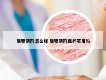 生物制剂怎么样 生物制剂真的有用吗