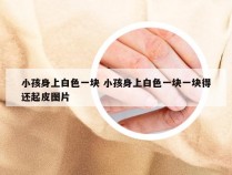 小孩身上白色一块 小孩身上白色一块一块得还起皮图片