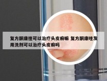 复方酮康挫可以治疗头皮癣嘛 复方酮康唑发用洗剂可以治疗头皮癣吗