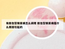 有脓包型银屑病怎么调理 脓包型银屑病是什么原因引起的