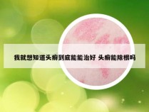 我就想知道头癣到底能能治好 头癣能除根吗