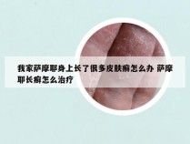 我家萨摩耶身上长了很多皮肤癣怎么办 萨摩耶长癣怎么治疗