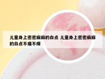 儿童身上密密麻麻的白点 儿童身上密密麻麻的白点不痛不痒