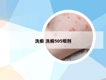 洗癣 洗癣505喷剂