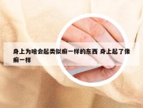 身上为啥会起类似癣一样的东西 身上起了像癣一样